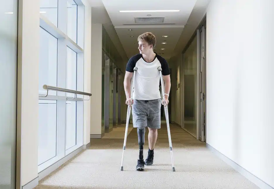 boy with prosthetic leg on crutches