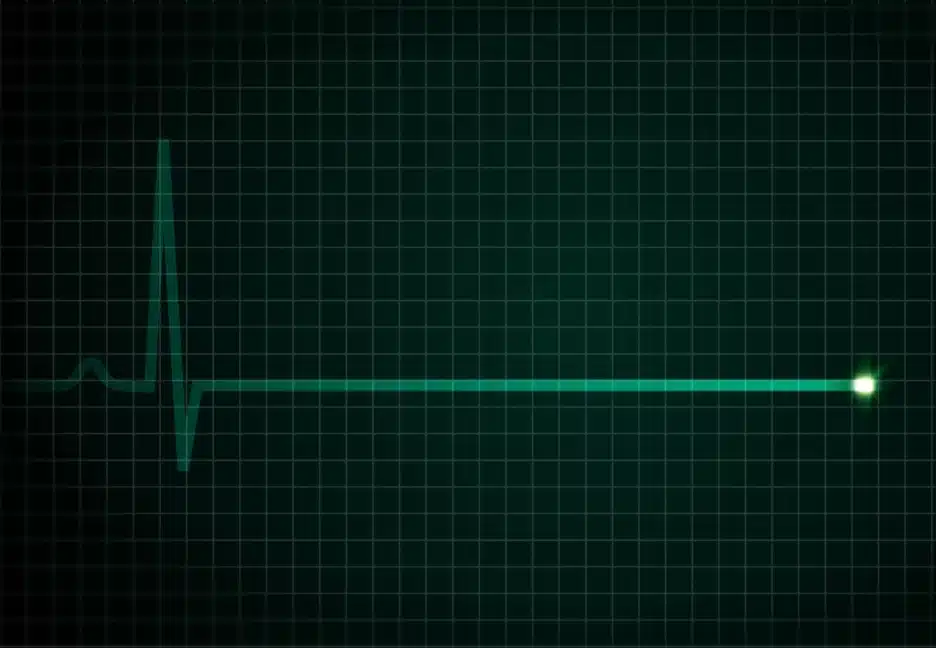 EKG flatline